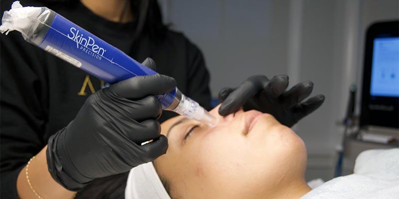 Spa Services - SkinPen Microneedling