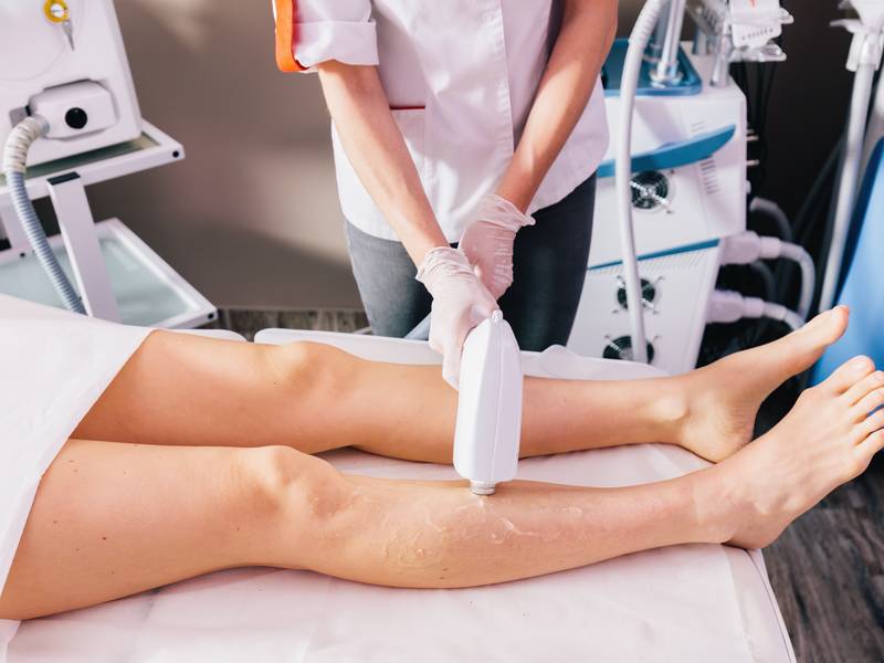 laser hair removal canton
