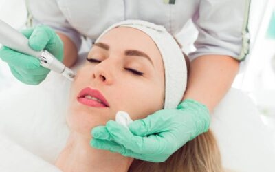 What Does Microneedling Do?