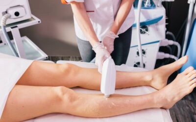 laser hair removal canton